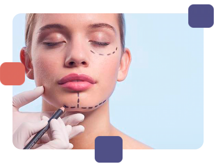 Mujer antes de cirugía facial