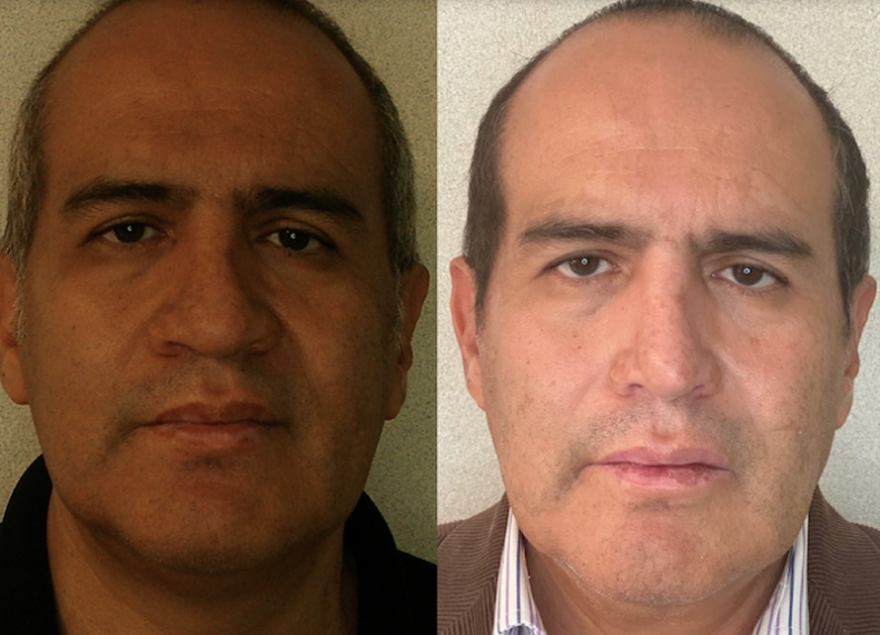RINO+LIPOPAPADA 4 MESES